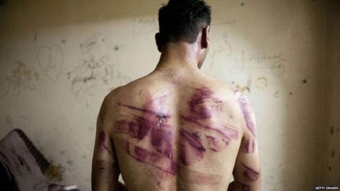 Nearly 18,000 died in Syria state jails in 2011-15, says Amnesty